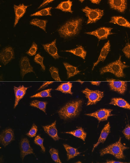 Anti-PDHA2 Antibody (CAB14994)