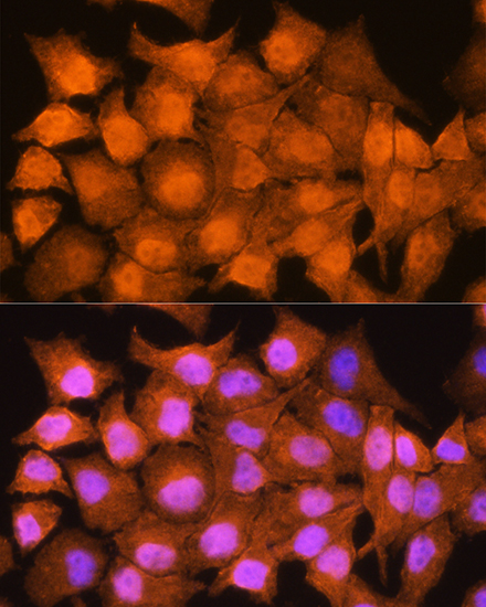 Anti-AIRE Antibody (CAB1767)