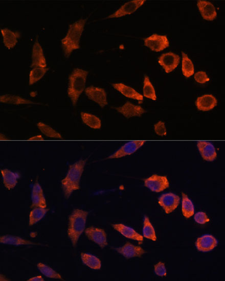 Anti-RAB5B Antibody (CAB7447)