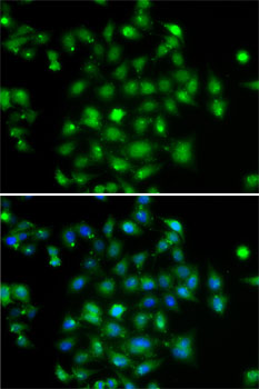 Anti-DYRK2 Antibody (CAB7012)