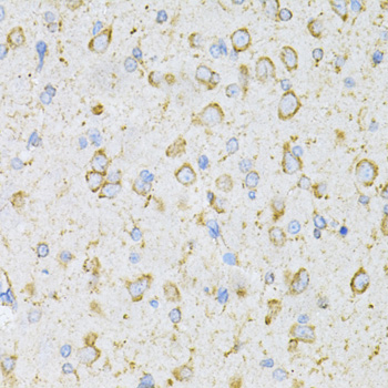 Anti-LRPAP1 Antibody (CAB3004)