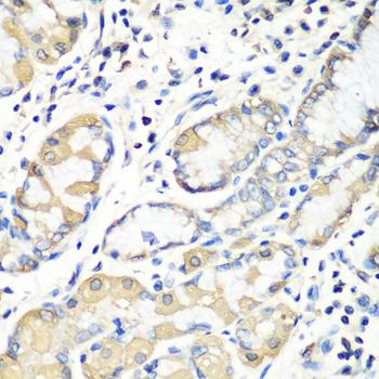 Anti-EZR Antibody (CAB0703)