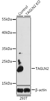 Anti-TAGLN2 Antibody [KO Validated] (CAB6761)