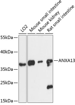 Anti-ANXA13 Antibody (CAB13728)