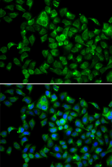 Anti-NAT8B Antibody (CAB13428)