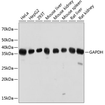 Anti-GAPDH Antibody (High Dilution) (CABC033)