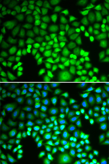 Anti-PSMA4 Antibody (CAB13535)