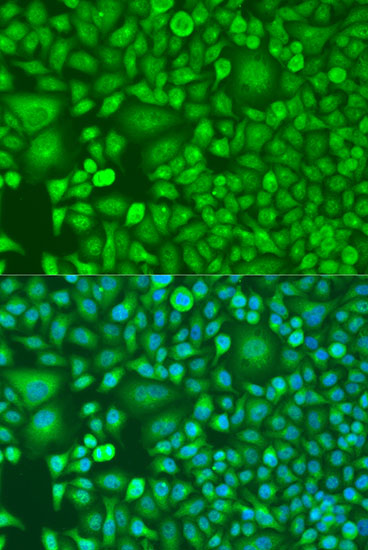 Anti-RARB Antibody (CAB1603)