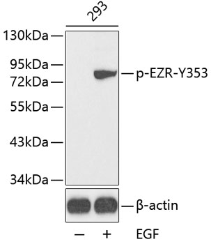 Anti-Phospho-Ezrin-Y353 Antibody (CABP0349)