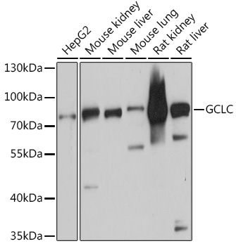 Anti-GCLC Antibody (CAB1038)