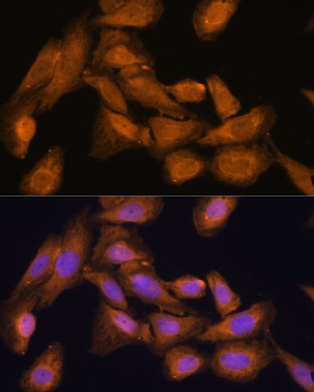 Anti-RPL27 Antibody (CAB13044)