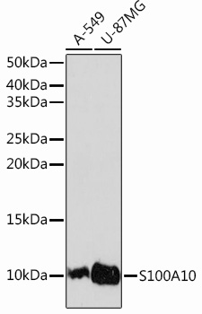 Anti-S100A10 Antibody