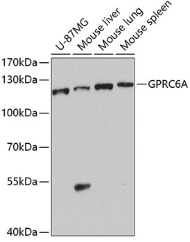 Anti-GPRC6A Polyclonal Antibody (CAB8525)