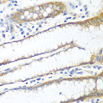 Anti-PPP4R1 Polyclonal Antibody (CAB8361)