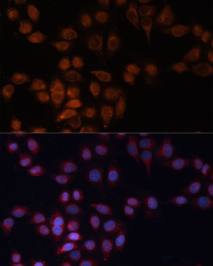 Anti-ADAM15 Antibody (CAB7756)