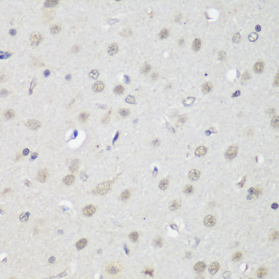 Anti-CTCF Antibody (CAB13272)