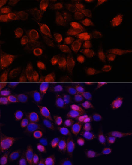 Anti-GLI1 Antibody (CAB14675)