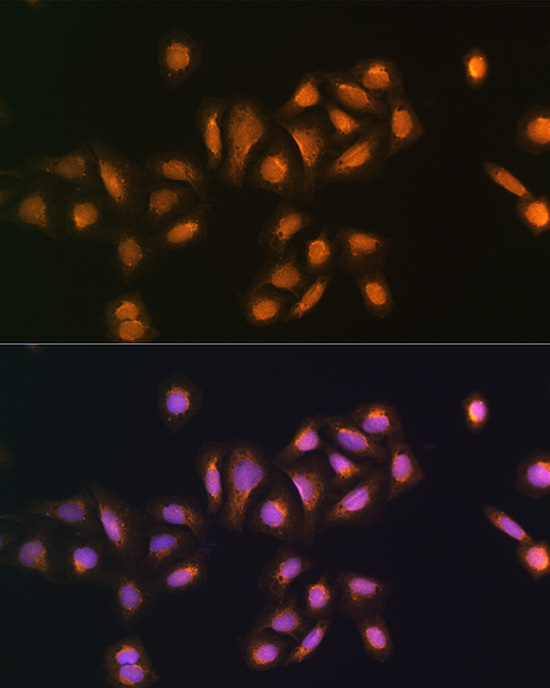 Anti-STK38 Polyclonal Antibody (CAB8191)