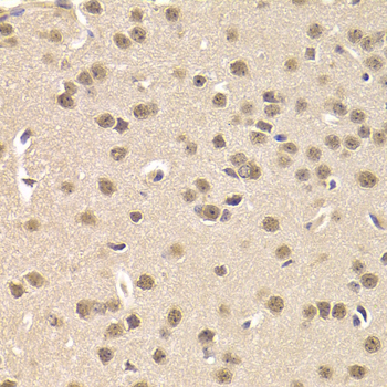 Anti-CSNK1E Antibody [KO Validated] (CAB1796)