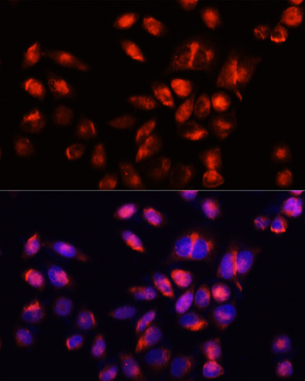 Anti-TIM-3/HAVCR2 Antibody (CAB13444)