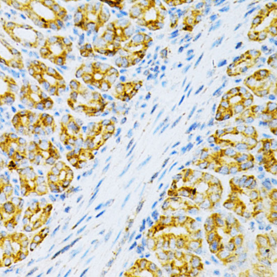 Anti-OLR1 Antibody (CAB1639)