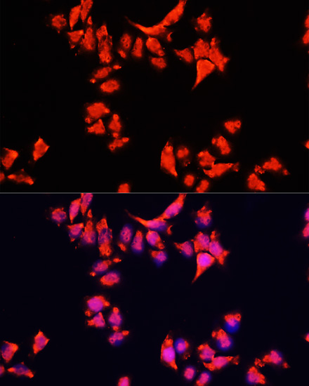 Anti-ARF1 Antibody (CAB16345)