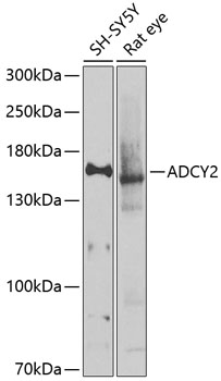 Anti-ADCY2 Polyclonal Antibody (CAB9805)