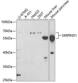 Anti-SERPIND1 Antibody (CAB5848)