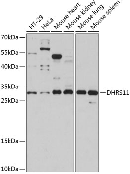 Anti-DHRS11 Antibody (CAB14422)