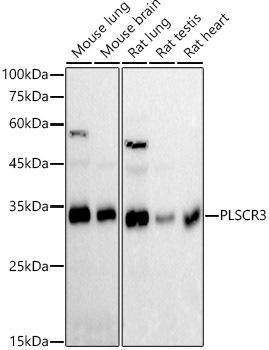 Western blot analysis of extracts of various cell lines, using PLSCR3 antibody at 1:1000 dilution. Secondary antibody: HRP Goat Anti-Rabbit IgG (H+L) at 1:10000 dilution. Lysates/proteins: 25ug per lane. Blocking buffer: 3% nonfat dry milk in TBST. Detection: ECL Basic Kit. Exposure time: 30s.