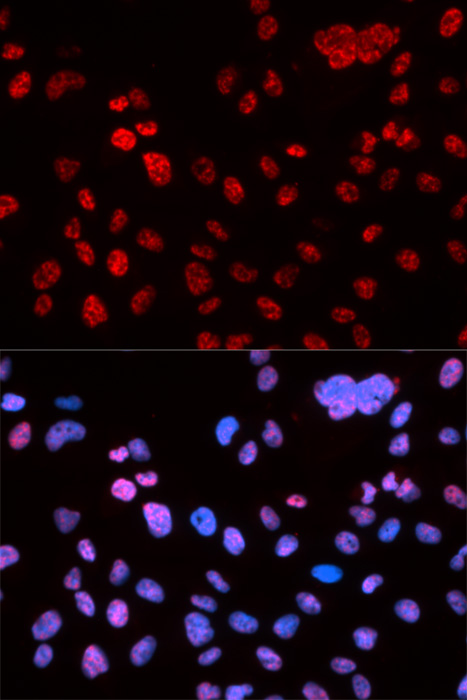 Anti-Phospho-p53-S9 Antibody (CABP0085)