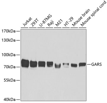 Anti-GARS Antibody (CAB5435)