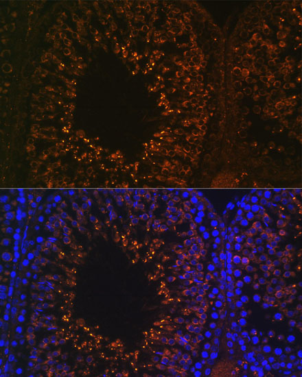 Anti-LDHAL6B Antibody (CAB14950)