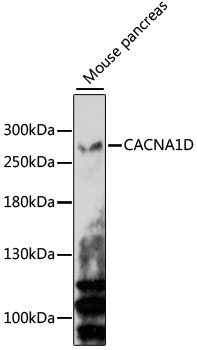 Anti-CACNA1D Antibody (CAB15034)