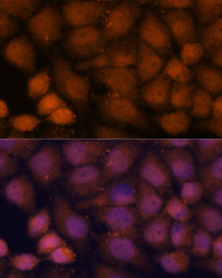 Anti-CEP85 Antibody (CAB15891)