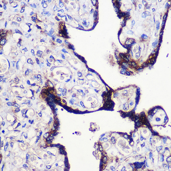 Anti-TRIM4 Antibody (CAB15922)