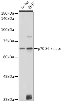 Anti-p70 S6 kinase Antibody (CAB16658)