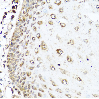 Anti-RAC2 Antibody (CAB1139)