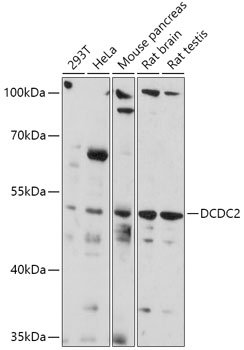 Anti-DCDC2 Antibody (CAB17704)