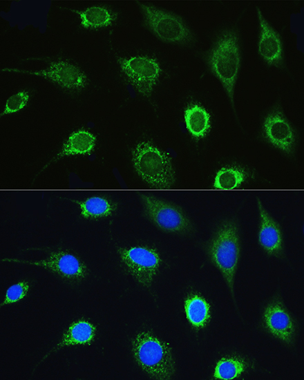 Anti-LARS Antibody (CAB14890)