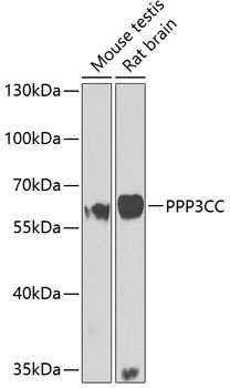 Anti-PPP3CC Antibody (CAB7714)