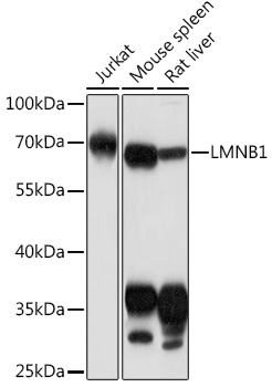 Anti-LMNB1 Antibody (CAB16910)