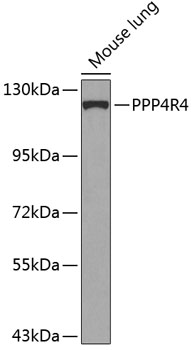 Anti-PPP4R4 Polyclonal Antibody (CAB8505)