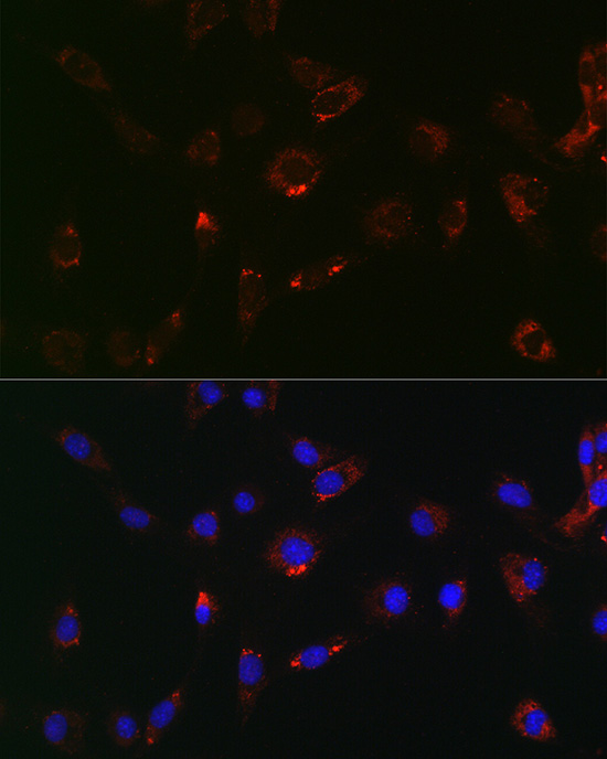 Anti-ATG14 Antibody (CAB7526)