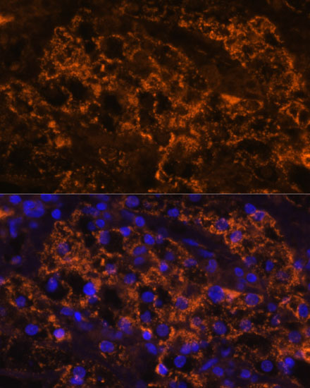 Anti-SLC7A9 Antibody (CAB12848)