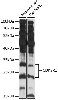 Anti-CDK5R1 Antibody (CAB14497)