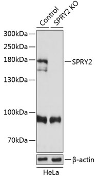 Anti-SPRY2 Antibody [KO Validated] (CAB19991)