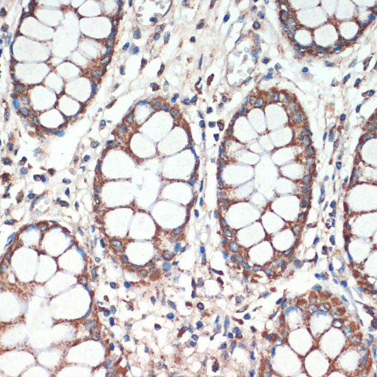 Anti-APC Antibody (CAB2818)