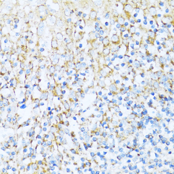 Anti-NDUFA5 Antibody [KO Validated] (CAB14751)