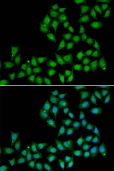 Anti-ELF1 Antibody (CAB6904)